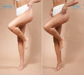 Side-by-side comparison of a woman’s legs, labeled Before and After, shows smoother, glowing skin in the After image—achieved with BondiSandsEU Tinted Skin Perfector Gradual Tanning Lotion.