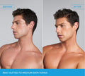 Side-by-side photos show a shirtless man with medium skin: "Before" displays a lighter complexion, "After" reveals a warmer, olive tan from BondiSandsEU Emerald Technocolor Self Tanning Face Serum. Best for medium tones; targets blemishes.