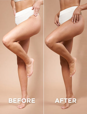 A woman shows off smoother, glowing legs in Before and After photos, revealing the effects of BondiSandsEU Skin Illuminator Gradual Tanning Lotion.